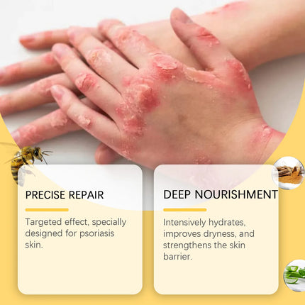 uñas Joint Care Health Cream Heel Pain Ointment Arthritis Dry Cracked Herbal Hydrating Feet - Gentle Exfoliation Daily Foot Care
